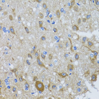 DYNC1I1 Rabbit pAb
