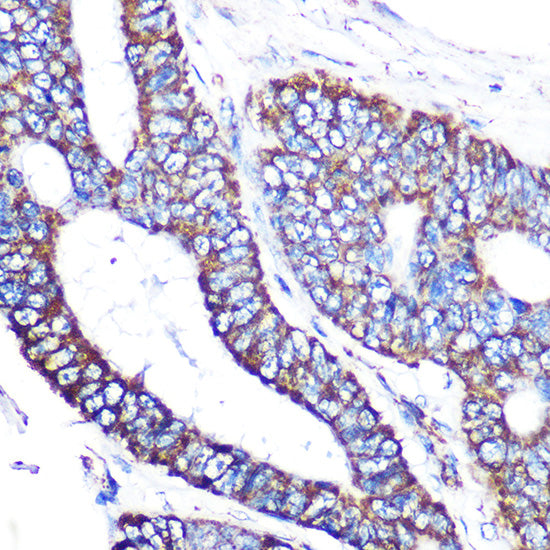 MTCO2 Rabbit mAb