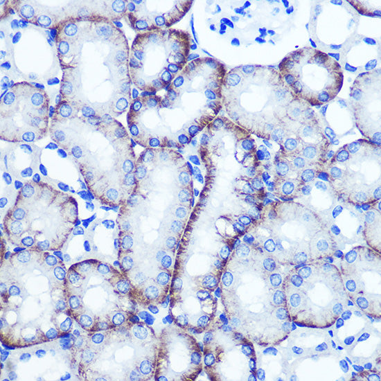 EXTL3 Rabbit pAb