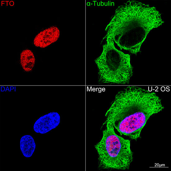 FTO Rabbit mAb