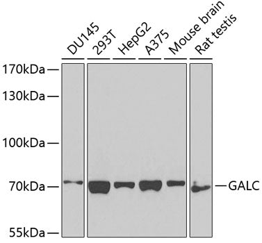 GALC Rabbit pAb