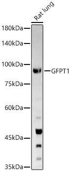 GFPT1 Rabbit pAb