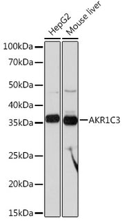 AKR1C3 Rabbit mAb
