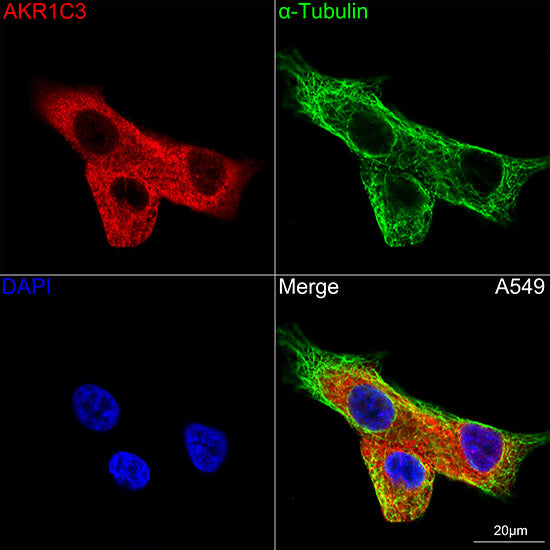 AKR1C3 Rabbit mAb