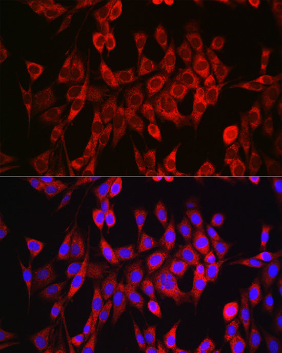 Glutaminase (GLS) Rabbit pAb