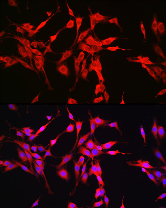 Glutaminase (GLS) Rabbit pAb