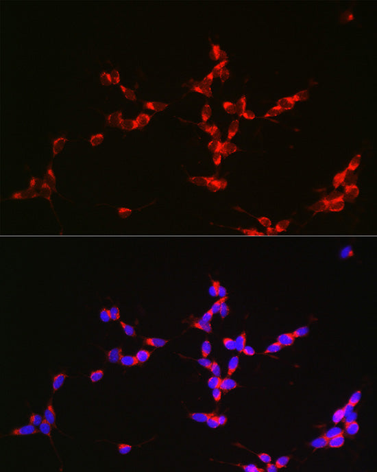 Glutaminase (GLS) Rabbit pAb