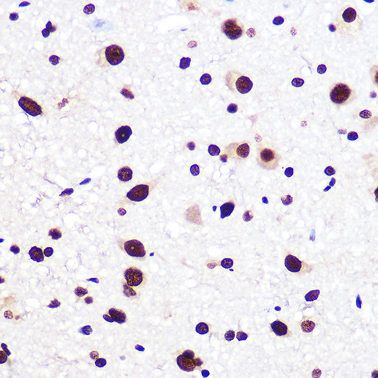 KHDRBS1/Sam68 Rabbit mAb