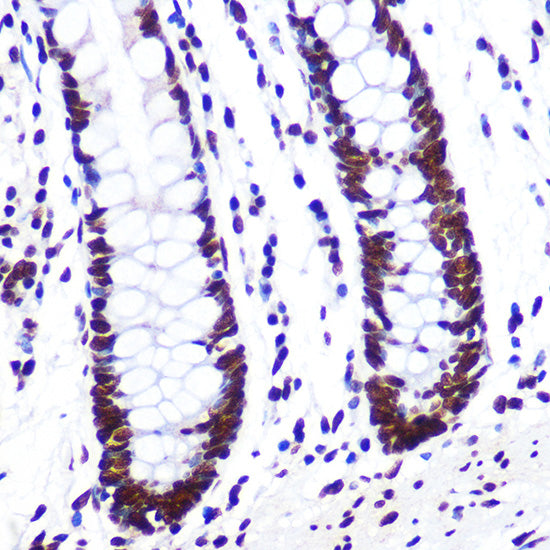 KHDRBS1/Sam68 Rabbit mAb