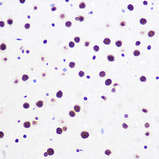 KHDRBS1/Sam68 Rabbit mAb