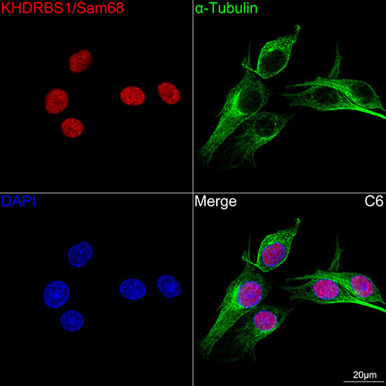 KHDRBS1/Sam68 Rabbit mAb