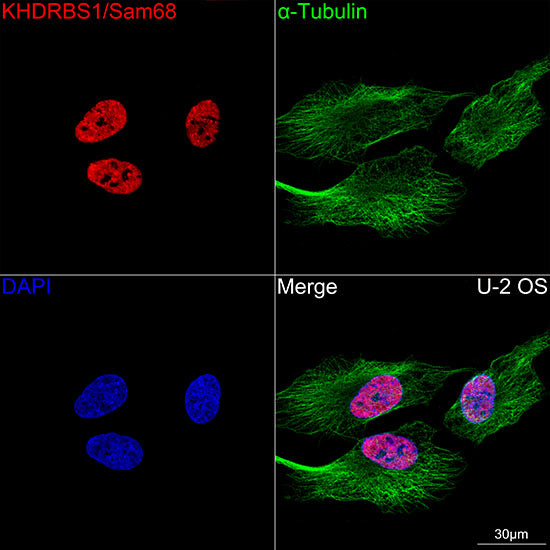 KHDRBS1/Sam68 Rabbit mAb