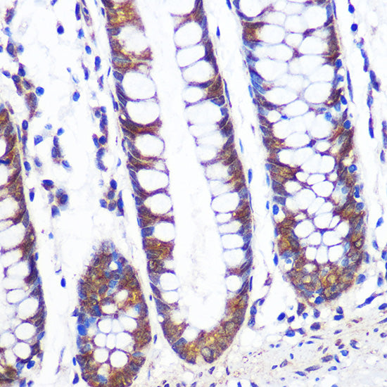 TCP1 alpha Rabbit mAb