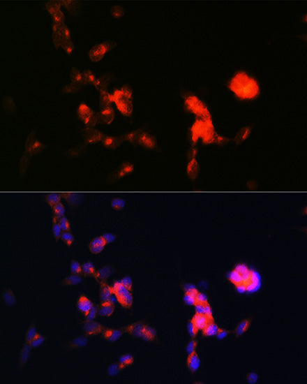 DKK3 Rabbit mAb