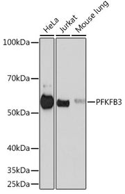 PFKFB3 Rabbit mAb