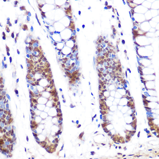 PFKFB3 Rabbit mAb