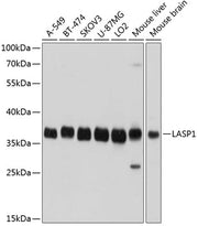 LASP1 Rabbit pAb