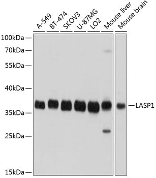 LASP1 Rabbit pAb