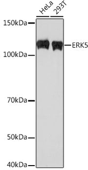ERK5 Rabbit mAb