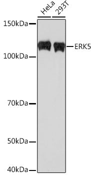 ERK5 Rabbit mAb