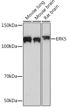 ERK5 Rabbit mAb