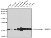 Peroxiredoxin 5 (PRDX5) Rabbit mAb