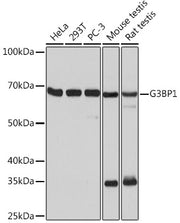 G3BP1 Rabbit mAb