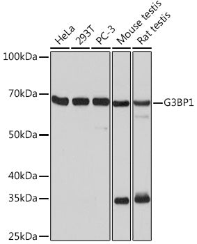 G3BP1 Rabbit mAb