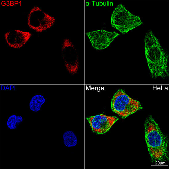 G3BP1 Rabbit mAb