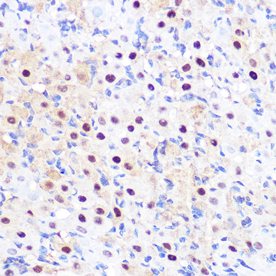LXRα Rabbit mAb
