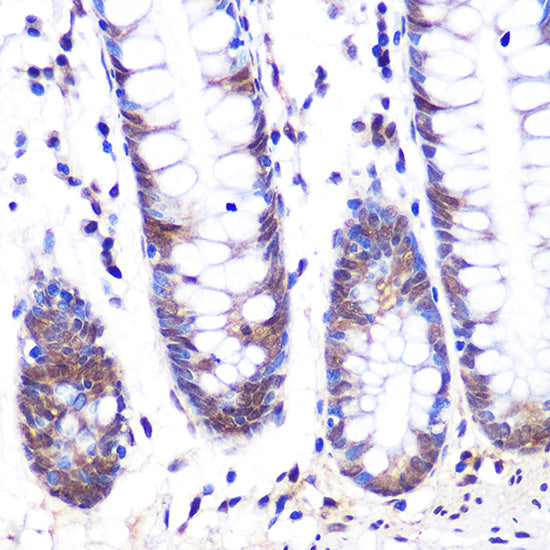LXRα Rabbit mAb