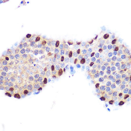 LXRα Rabbit mAb