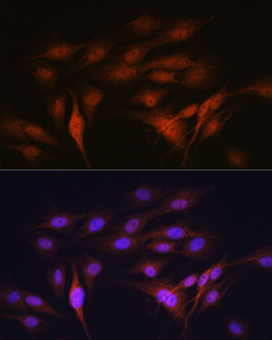 LXRα Rabbit mAb
