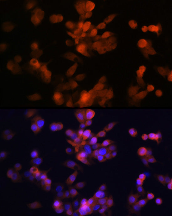 LXRα Rabbit mAb