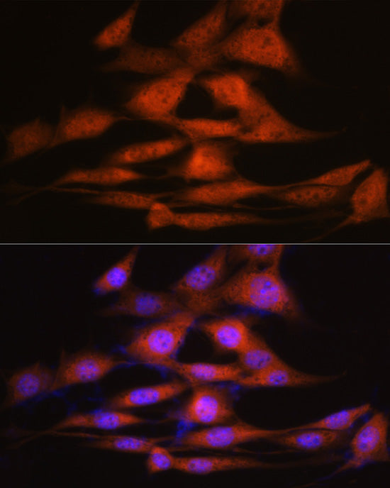LXRα Rabbit mAb