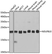 NDUFB10 Rabbit pAb