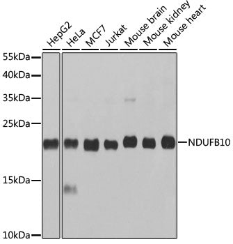 NDUFB10 Rabbit pAb