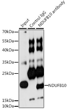NDUFB10 Rabbit pAb