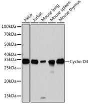 Cyclin D3 Rabbit mAb