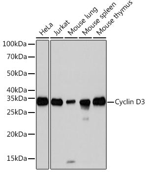 Cyclin D3 Rabbit mAb