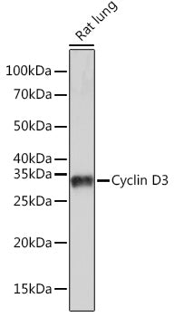 Cyclin D3 Rabbit mAb