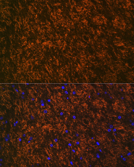 Myelin oligodendrocyte glycoprotein Rabbit mAb