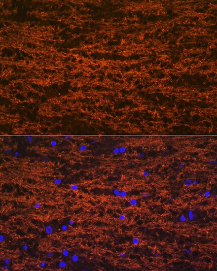 Myelin oligodendrocyte glycoprotein Rabbit mAb