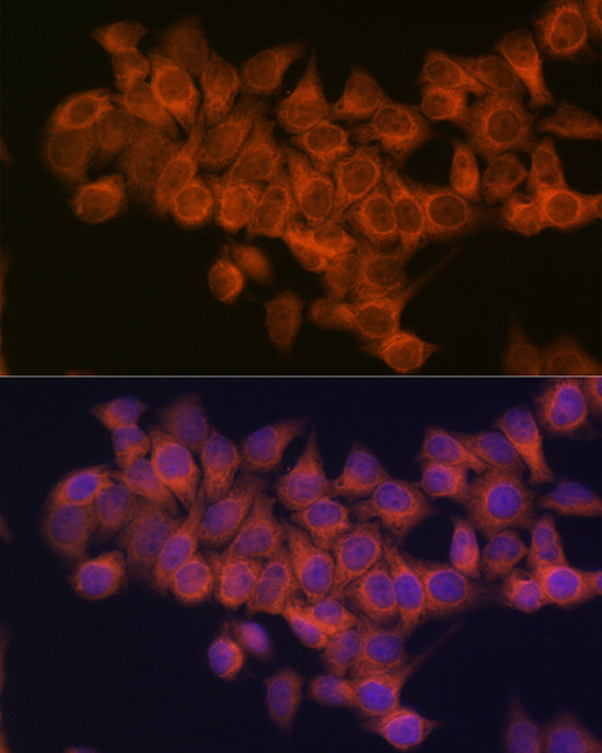 NDUFAF1 Rabbit mAb