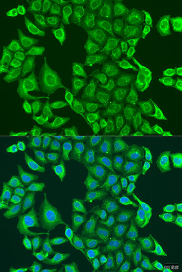 PDK2 Rabbit pAb