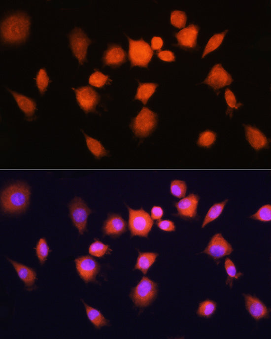 PGAM1 Rabbit pAb