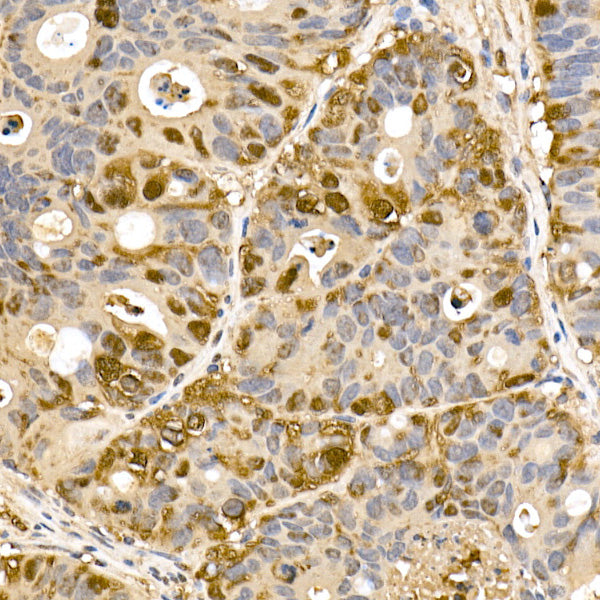Thioredoxin 1 (Trx1/TXN) Rabbit mAb