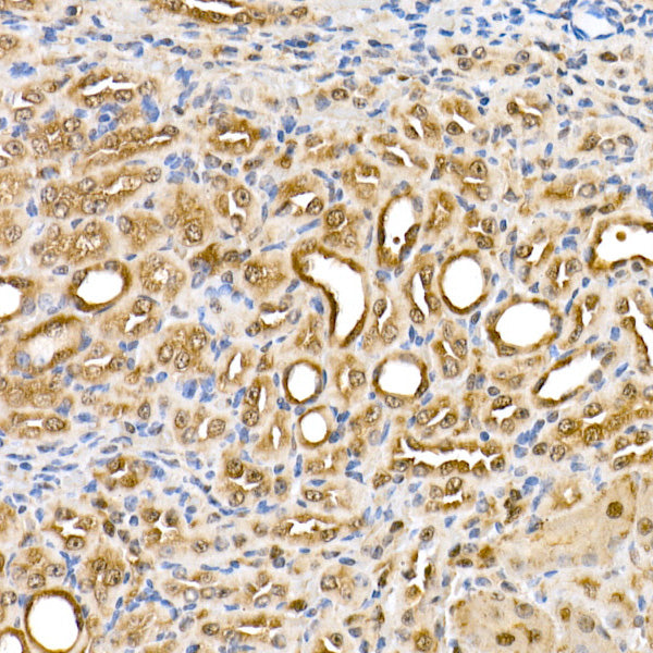 Thioredoxin 1 (Trx1/TXN) Rabbit mAb