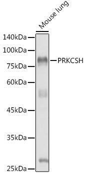 PRKCSH Rabbit pAb