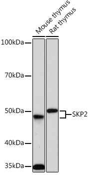 SKP2 Rabbit mAb